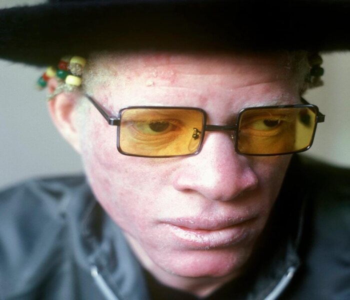 The one and only Yellowman - real name being Winston Foster.
